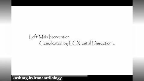 Left Main Intervention Complicated by LCX Ostial Dissection