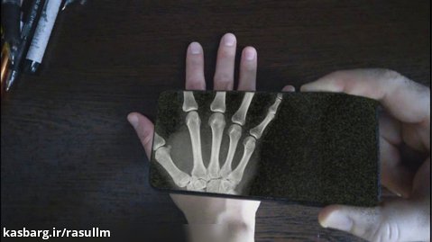 نمایش استخوان دست با اشعه ایکس در موبایل
