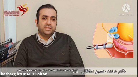 نمونه برداری از پروستات - دکتر محمد حسین سلطانی جراح کلیه و مجاری ادراری