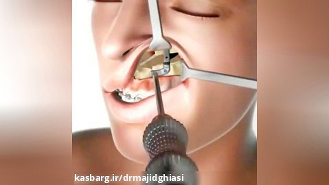 ارتودنسی دندان مشهد